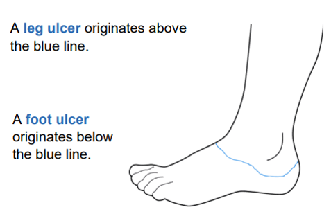 Lower Limb pathway diagram